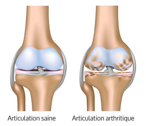 arthrose et remedes naturels chez le chat