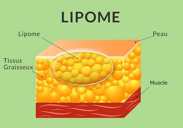 Lipome Du Chien Resorber Les Boules De Graisses Chez Le Chien Remedes Naturels Pour Animaux